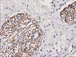 PDLIM2 Antibody in Immunohistochemistry (Paraffin) (IHC (P))