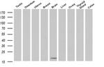 ECRG4 Antibody in Western Blot (WB)