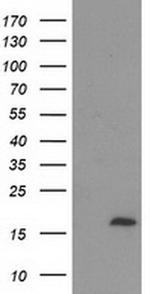 ECRG4 Antibody in Western Blot (WB)