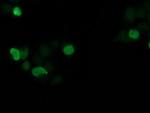 SSX1 Antibody in Immunocytochemistry (ICC/IF)