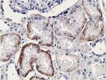 SSX1 Antibody in Immunohistochemistry (Paraffin) (IHC (P))