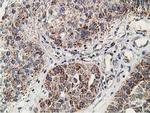 SSX1 Antibody in Immunohistochemistry (Paraffin) (IHC (P))