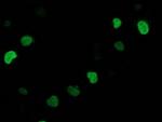 SSX1 Antibody in Immunocytochemistry (ICC/IF)