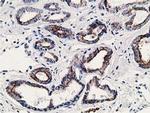 SSX1 Antibody in Immunohistochemistry (Paraffin) (IHC (P))