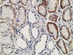 SSX1 Antibody in Immunohistochemistry (Paraffin) (IHC (P))