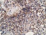 SSX1 Antibody in Immunohistochemistry (Paraffin) (IHC (P))