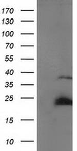 SSX1 Antibody in Western Blot (WB)