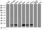 RBP1 Antibody in Western Blot (WB)