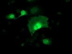 Alcohol Dehydrogenase 1B Antibody in Immunocytochemistry (ICC/IF)