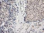 Alcohol Dehydrogenase 1B Antibody in Immunohistochemistry (Paraffin) (IHC (P))