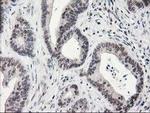 Alcohol Dehydrogenase 1B Antibody in Immunohistochemistry (Paraffin) (IHC (P))