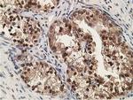 Alcohol Dehydrogenase 1B Antibody in Immunohistochemistry (Paraffin) (IHC (P))