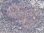 Alcohol Dehydrogenase 1B Antibody in Immunohistochemistry (Paraffin) (IHC (P))