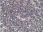 Alcohol Dehydrogenase 1B Antibody in Immunohistochemistry (Paraffin) (IHC (P))