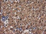 Alcohol Dehydrogenase 1B Antibody in Immunohistochemistry (Paraffin) (IHC (P))