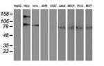 Alcohol Dehydrogenase 1B Antibody in Western Blot (WB)