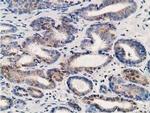 ALDH1A3 Antibody in Immunohistochemistry (Paraffin) (IHC (P))