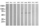 ALDH1A3 Antibody in Western Blot (WB)