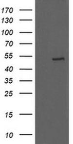 UBOX5 Antibody in Western Blot (WB)