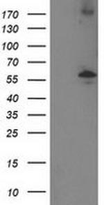 PPM1B Antibody in Western Blot (WB)