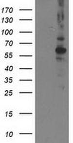 PPM1B Antibody in Western Blot (WB)