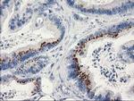 Monoacylglycerol Lipase Antibody in Immunohistochemistry (Paraffin) (IHC (P))