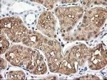 Aldolase B Antibody in Immunohistochemistry (Paraffin) (IHC (P))