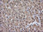 Alcohol Dehydrogenase 1B Antibody in Immunohistochemistry (Paraffin) (IHC (P))