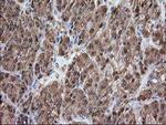 Alcohol Dehydrogenase 1B Antibody in Immunohistochemistry (Paraffin) (IHC (P))