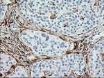 Alcohol Dehydrogenase 1B Antibody in Immunohistochemistry (Paraffin) (IHC (P))