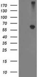 Alcohol Dehydrogenase 1B Antibody in Western Blot (WB)