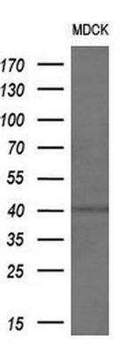 Alcohol Dehydrogenase 1B Antibody in Western Blot (WB)