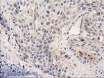 PLEKHA3 Antibody in Immunohistochemistry (Paraffin) (IHC (P))