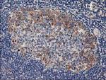 PLEKHA3 Antibody in Immunohistochemistry (Paraffin) (IHC (P))