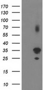 PLEKHA3 Antibody in Western Blot (WB)