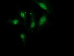 Monoacylglycerol Lipase Antibody in Immunocytochemistry (ICC/IF)