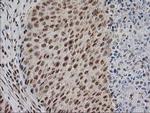 Monoacylglycerol Lipase Antibody in Immunohistochemistry (Paraffin) (IHC (P))