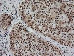 Monoacylglycerol Lipase Antibody in Immunohistochemistry (Paraffin) (IHC (P))