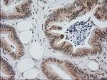 Monoacylglycerol Lipase Antibody in Immunohistochemistry (Paraffin) (IHC (P))