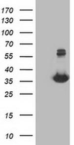 Monoacylglycerol Lipase Antibody in Western Blot (WB)