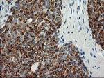 Adenylate Kinase 4 Antibody in Immunohistochemistry (Paraffin) (IHC (P))