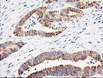 Adenylate Kinase 4 Antibody in Immunohistochemistry (Paraffin) (IHC (P))