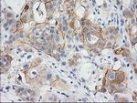 BAIAP2 Antibody in Immunohistochemistry (Paraffin) (IHC (P))