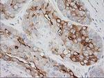 BAIAP2 Antibody in Immunohistochemistry (Paraffin) (IHC (P))