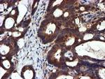 NDUFAF7 Antibody in Immunohistochemistry (Paraffin) (IHC (P))