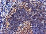 NDUFAF7 Antibody in Immunohistochemistry (Paraffin) (IHC (P))