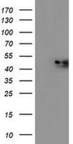 NDUFAF7 Antibody in Western Blot (WB)