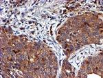 LIMK1 Antibody in Immunohistochemistry (Paraffin) (IHC (P))