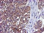 LIMK1 Antibody in Immunohistochemistry (Paraffin) (IHC (P))