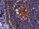 LIMK1 Antibody in Immunohistochemistry (Paraffin) (IHC (P))